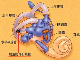 一动就天旋地转？带你认识耳石症