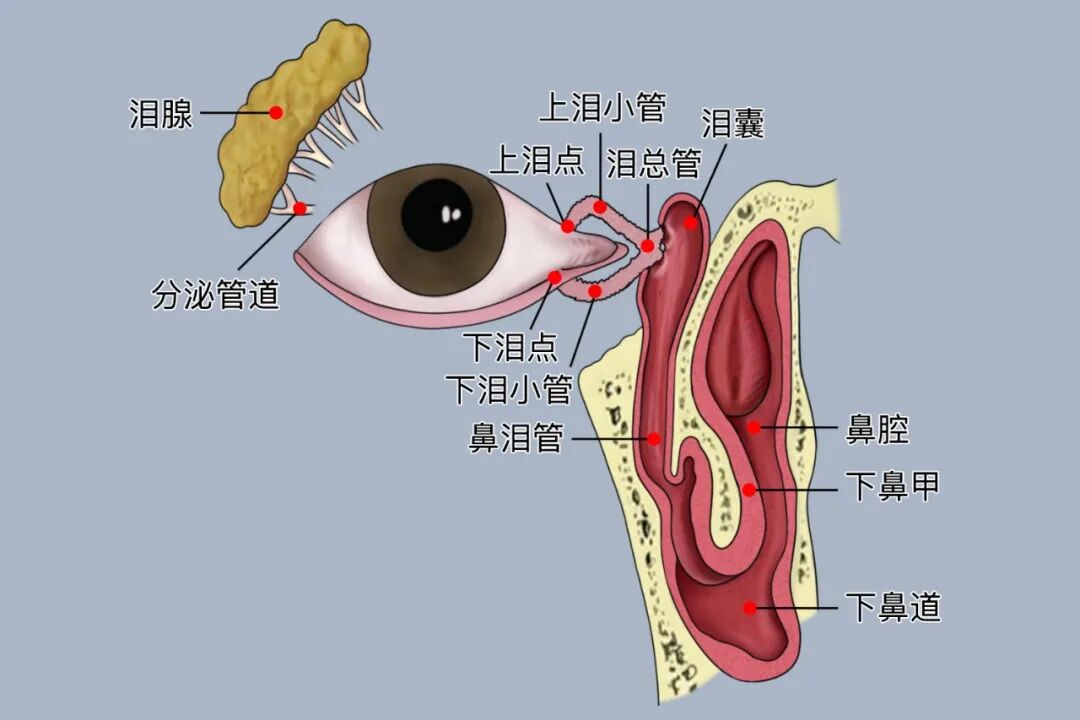 触目惊心!工地木棍砸伤右眼,上下泪小管双双断裂——跨城求医,王鹤主任紧急“接通”泪道