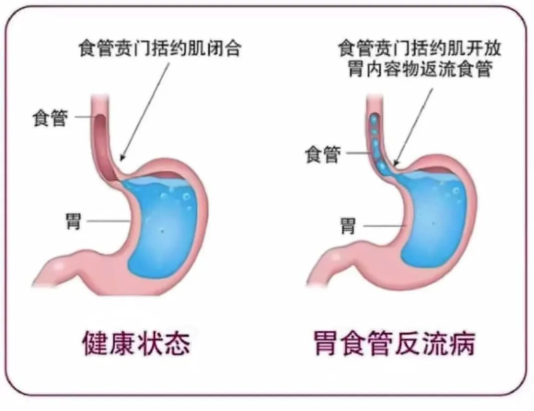 九旬老人胃“移位扭转”辗转求医,荆门市中心医院多学科协作勇闯高龄手术难关