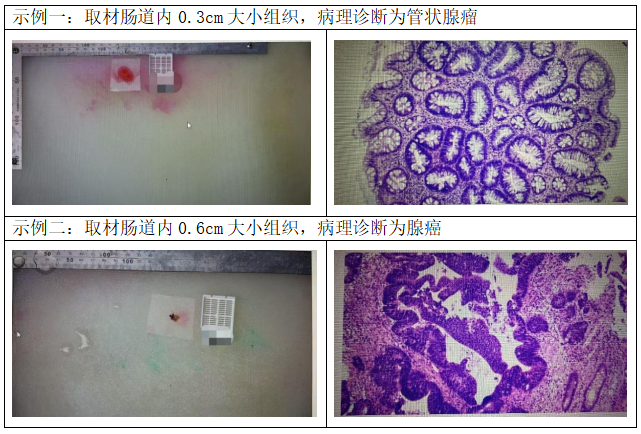 医语辟谣｜活检是“割肉”？一穿刺癌细胞“满天飞”？这些病理检查谣言不要信
