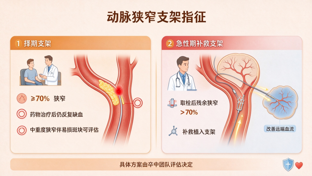 专家讲科普｜血管放支架，不是“一放了之”！术前术后这些坑千万别踩