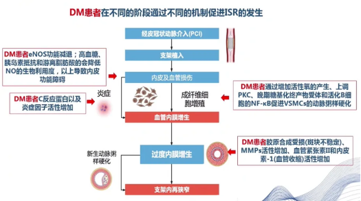 血糖高了，支架也 “撑不住”