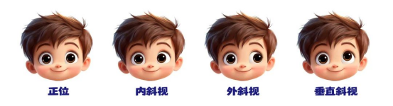 孩子斜视，手术会影响视力吗？要不要做、多久能恢复？一次说清