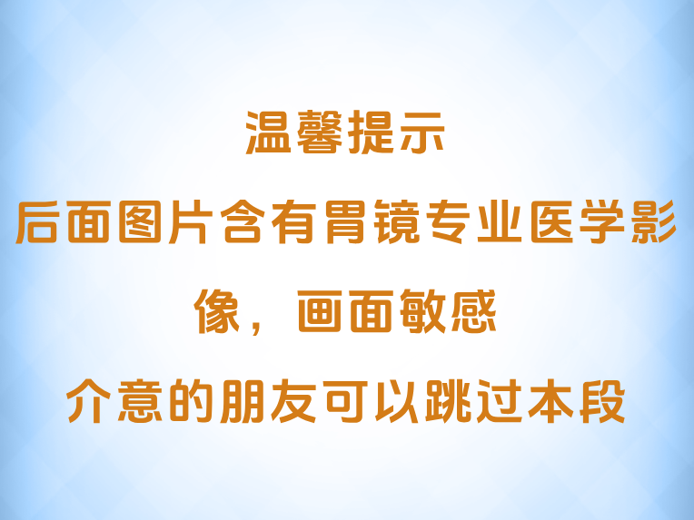 山楂、柿子别猛炫！一不小心吃出胃结石