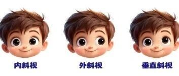 孩子斜视，手术会影响视力吗？要不要做、多久能恢复？一次说清
