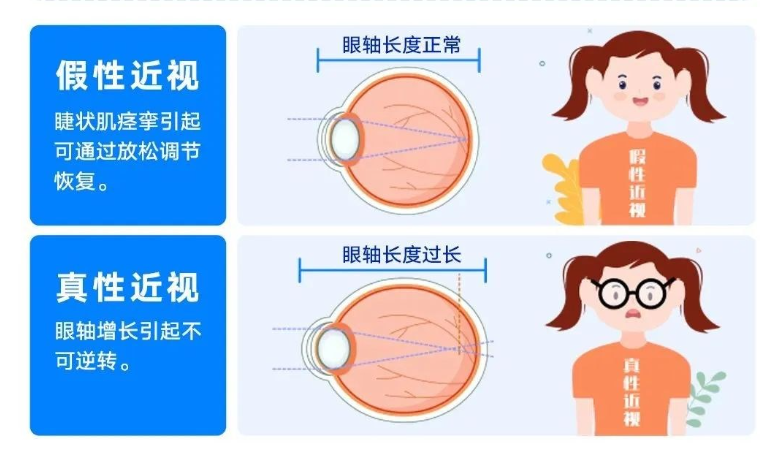 天天刷手机的你,这3个“护眼习惯”其实在毁眼睛!