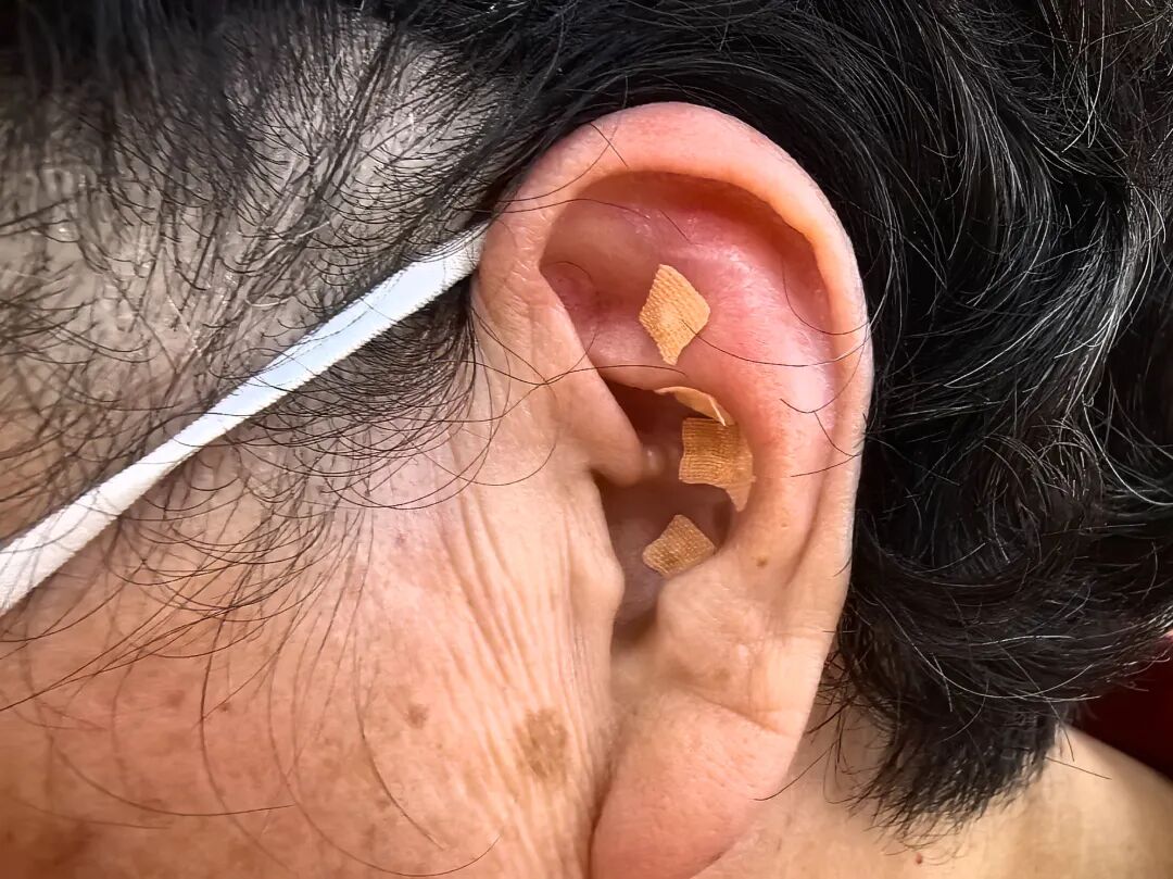 “银龄悦听・爱耳同行” 敬老月义诊暖人心