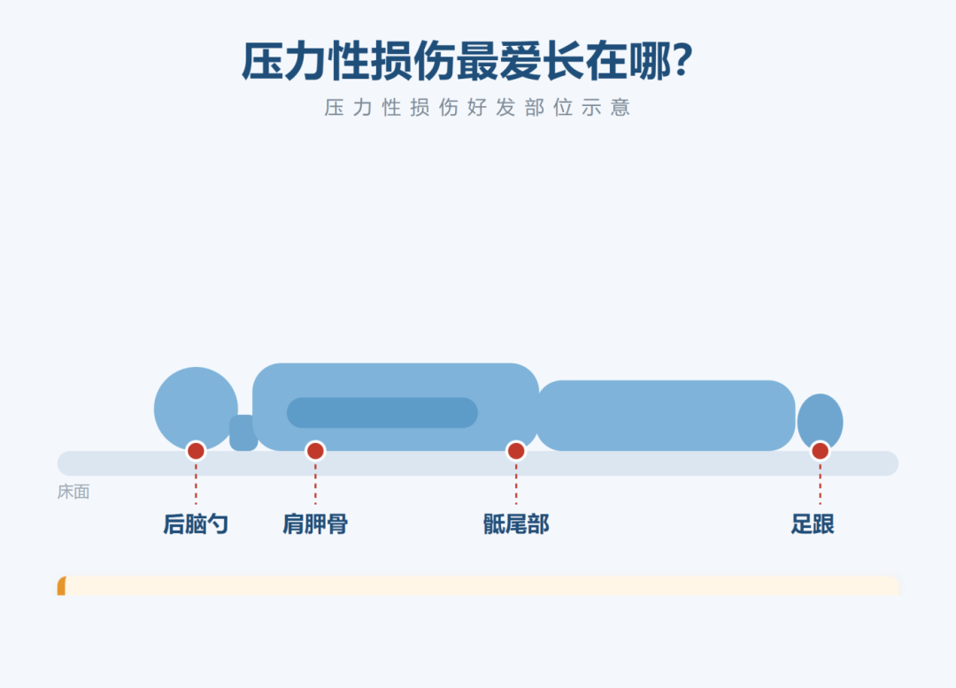 翻身发现皮肤红、按了不褪色？警惕压力性损伤找上门