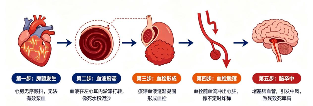 “医生，我心慌得厉害，心脏像在胸口里‘蹦迪’！”认识房颤：准确识别科学防范