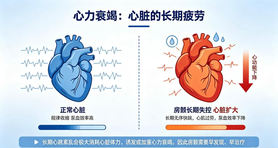 “医生,我心慌得厉害,心脏像在胸口里‘蹦迪’!”认识房颤:准确识别科学防范