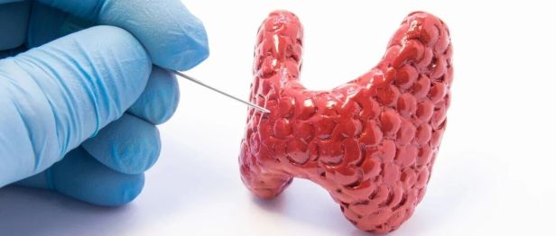 15岁高中生确诊甲状腺癌，脖子查出结节别慌，绝大多数是……