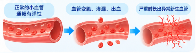 瑞科普丨眼睛看得清，眼底就没问题？糖尿病患者，这份护眼提醒请收好