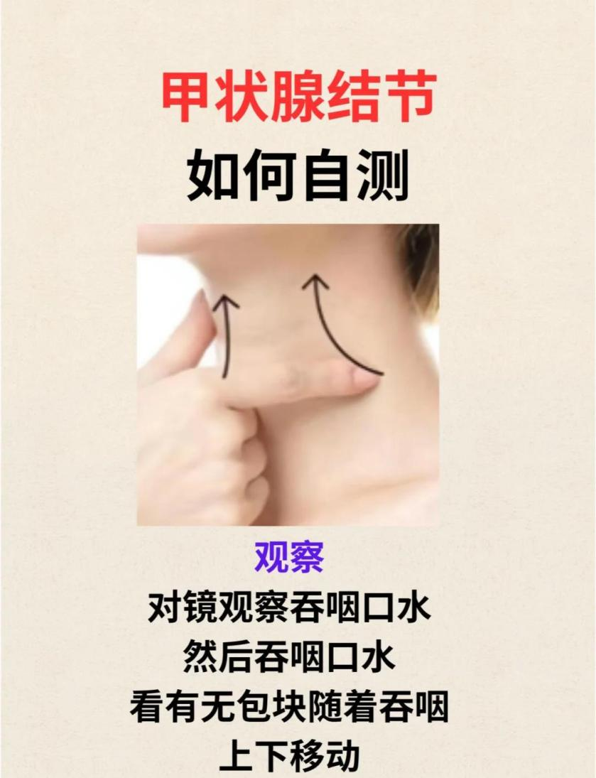 查出甲状腺肿块,先别慌!90%都是良性的