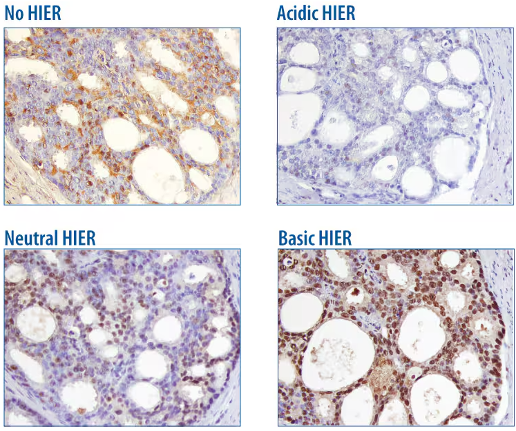 抗原修复方法 Antigen Retrieval Methods