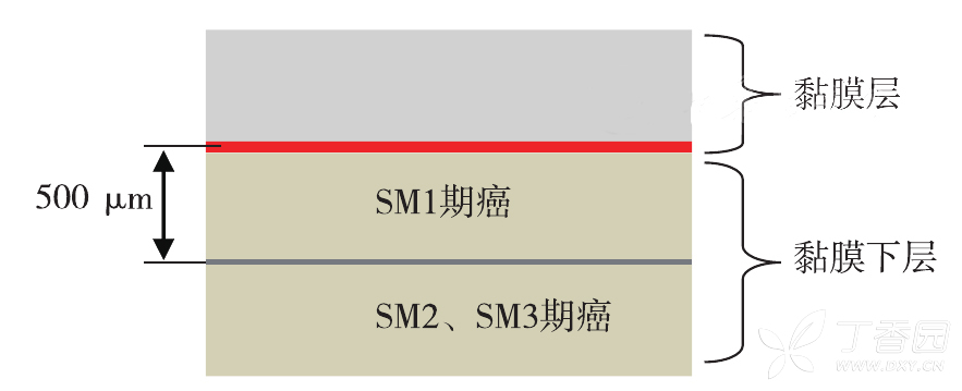 图片预览