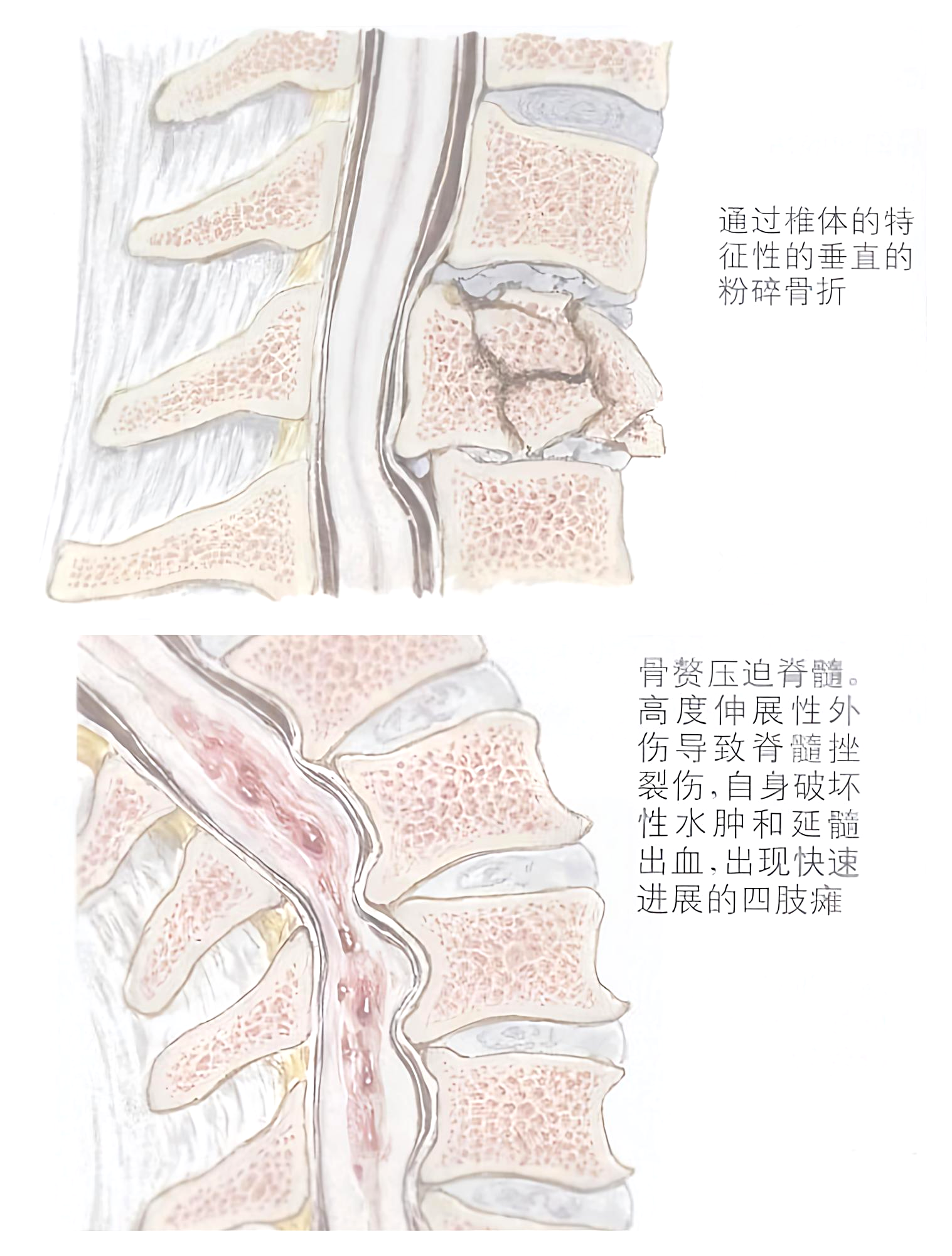 图片预览