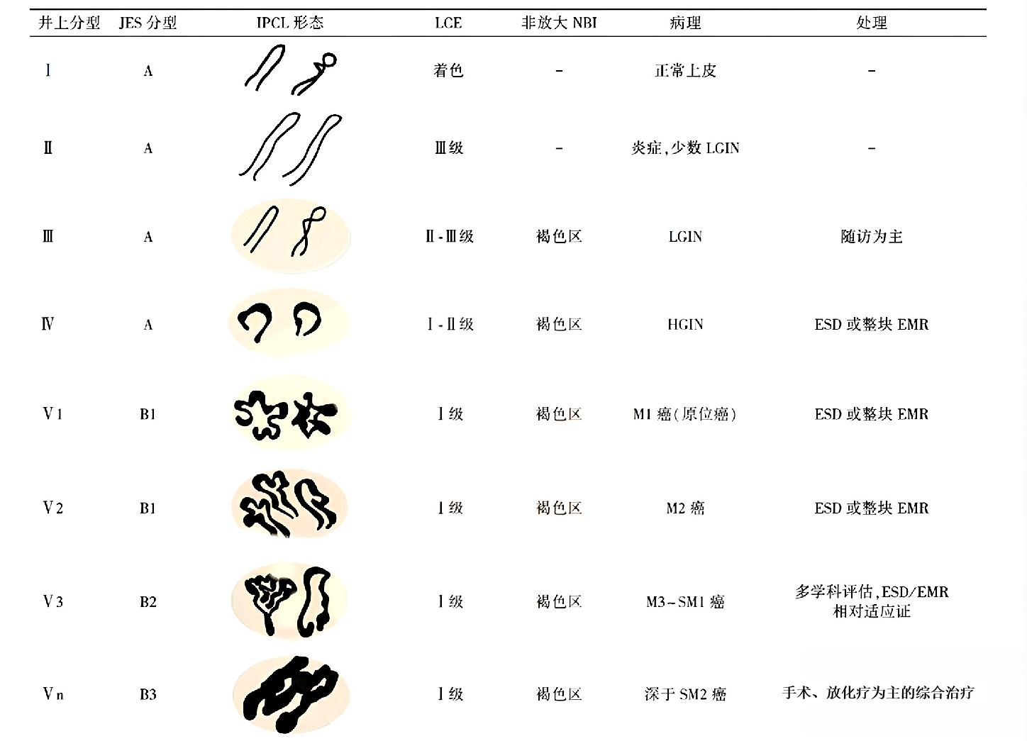 图片预览