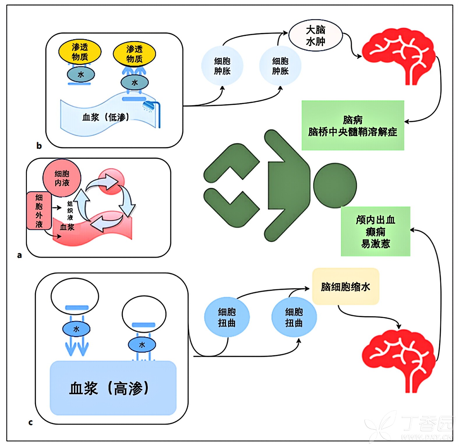 图片预览