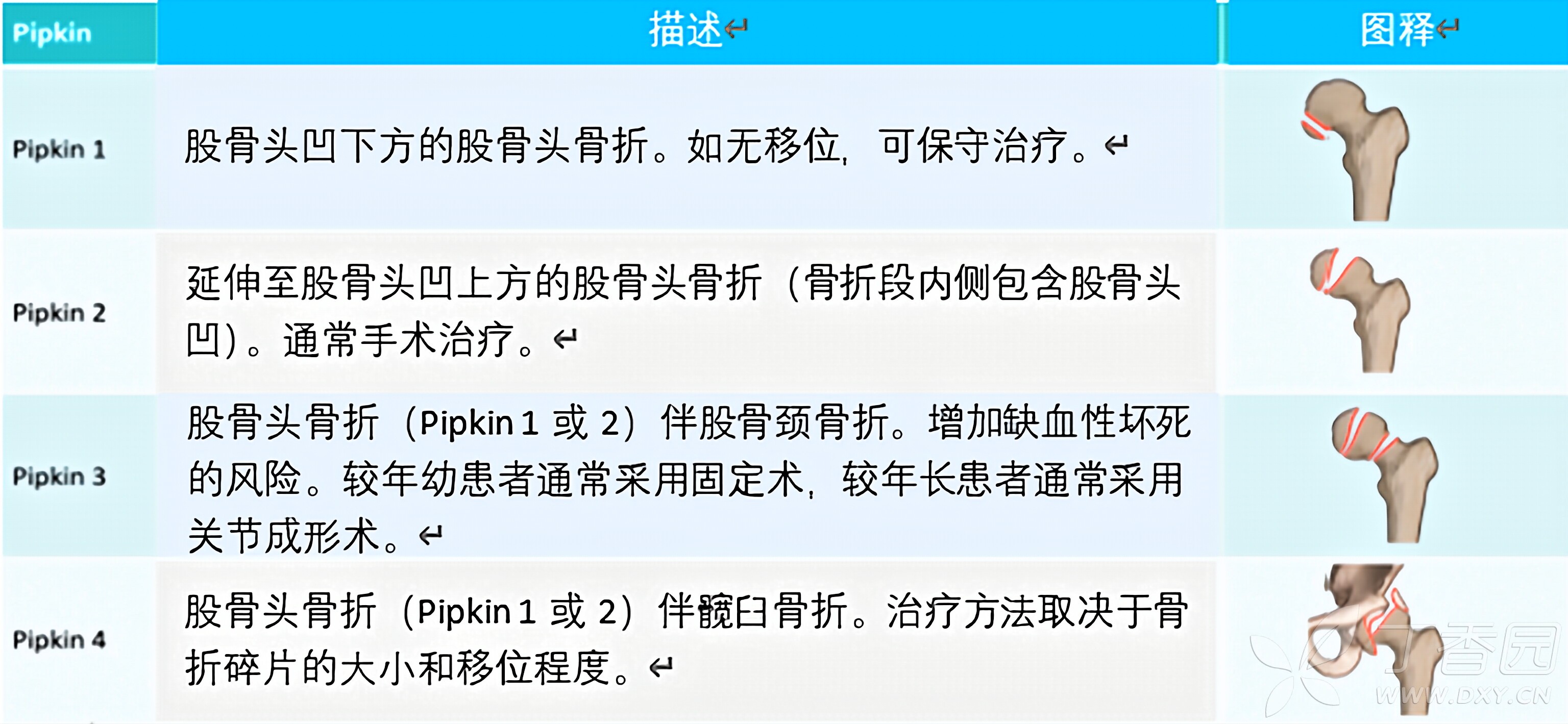 图片预览