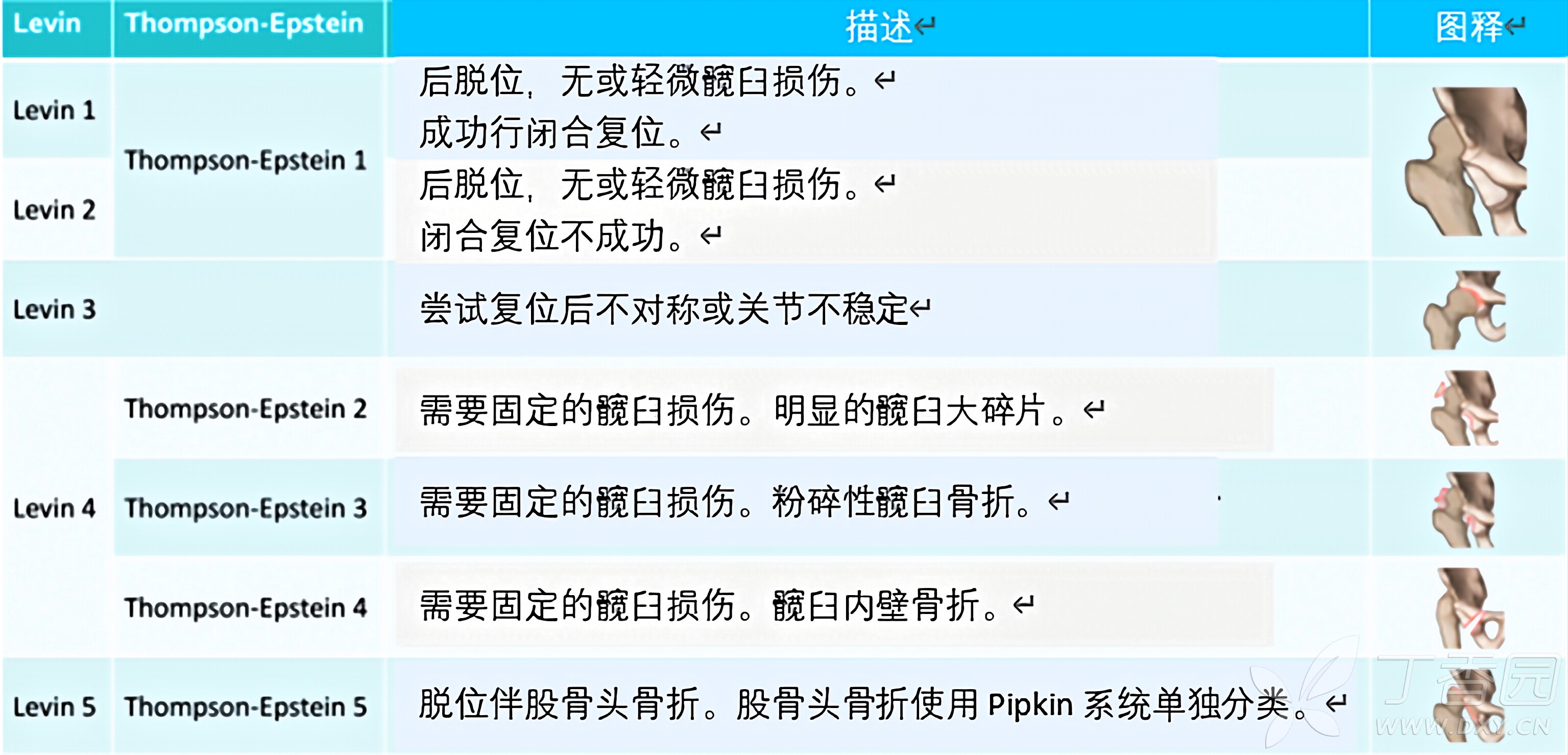 图片预览