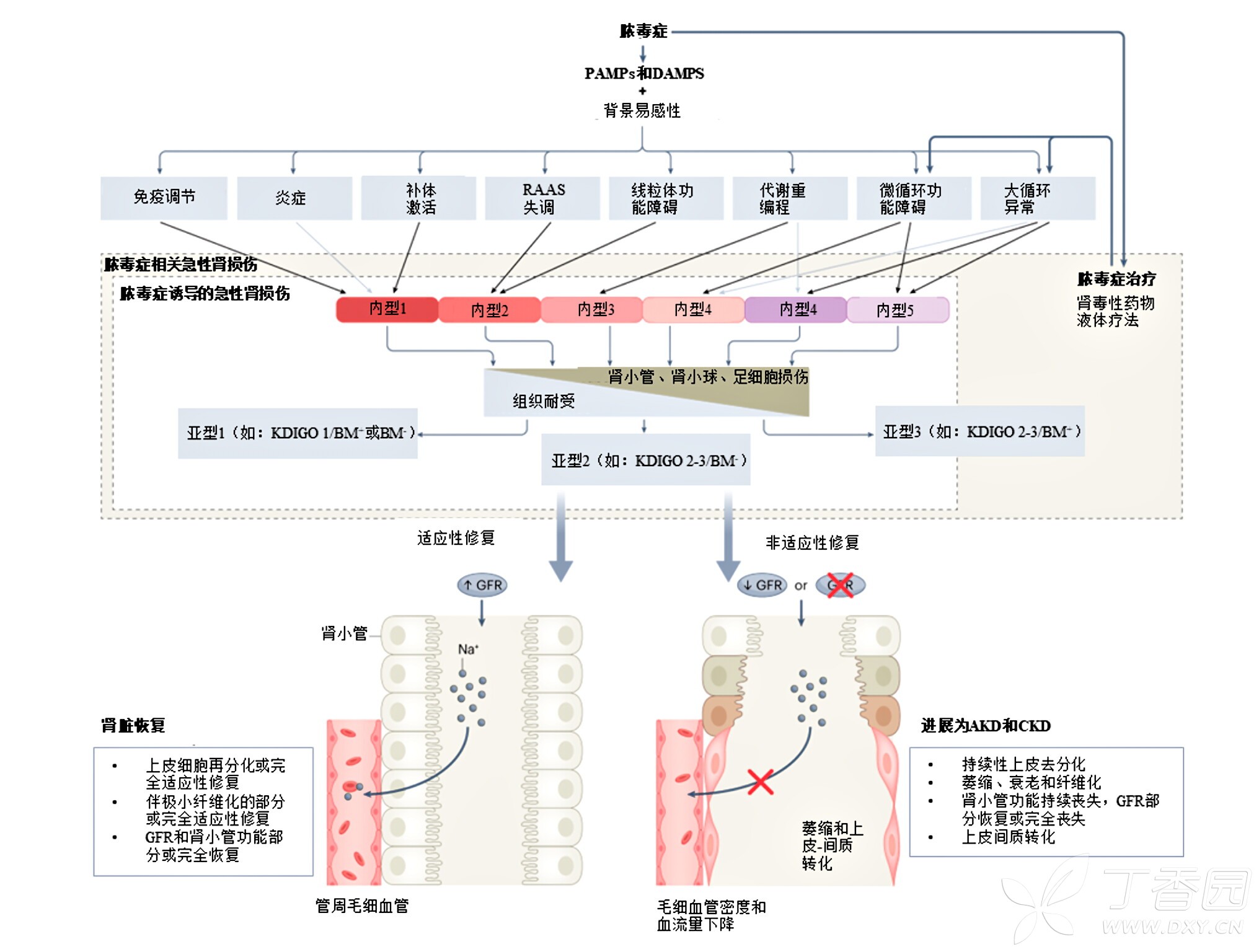 脓毒症相关急性肾损伤