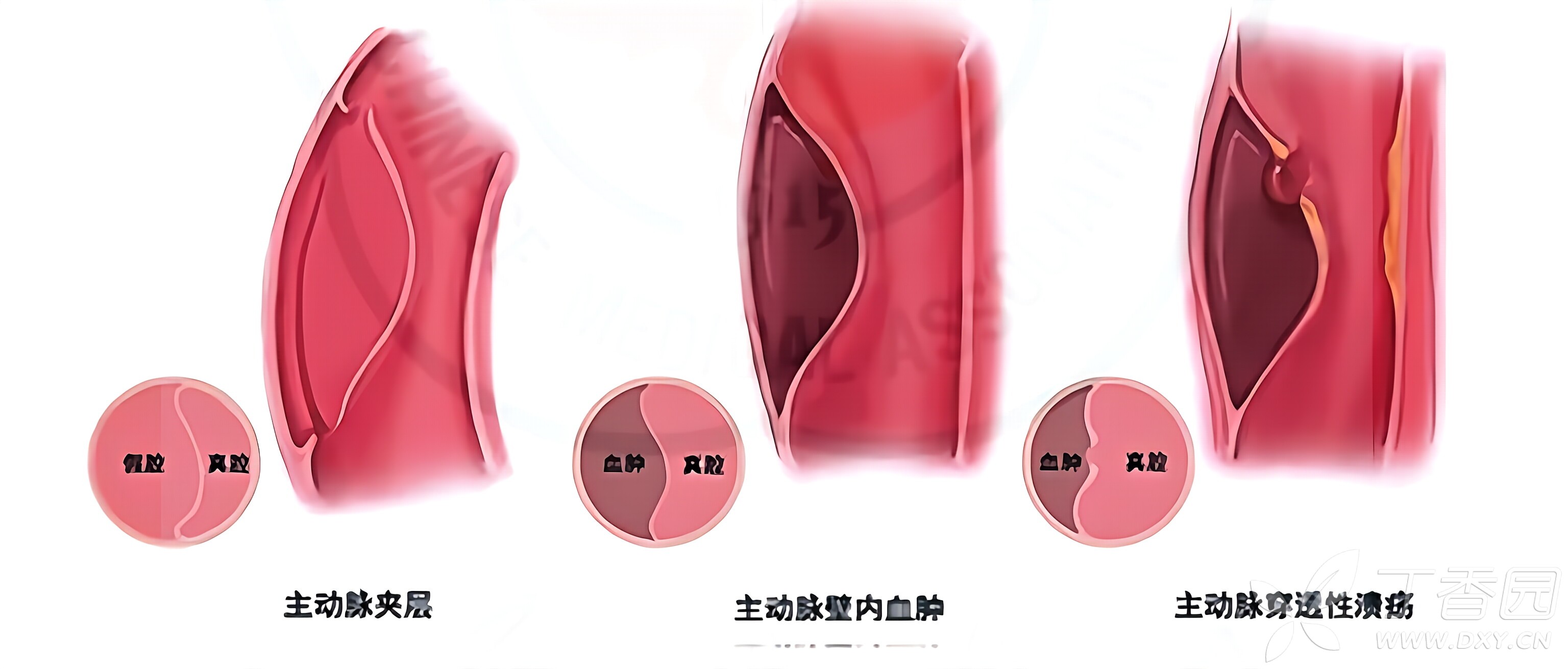 图片预览