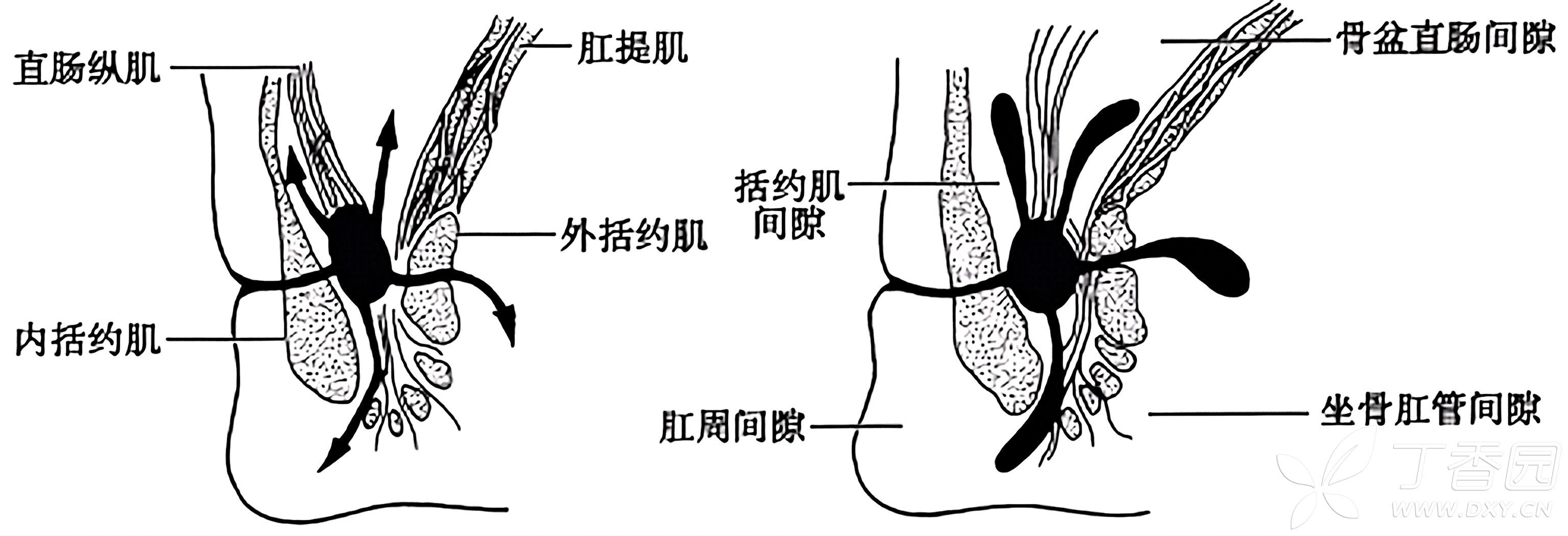 图片预览