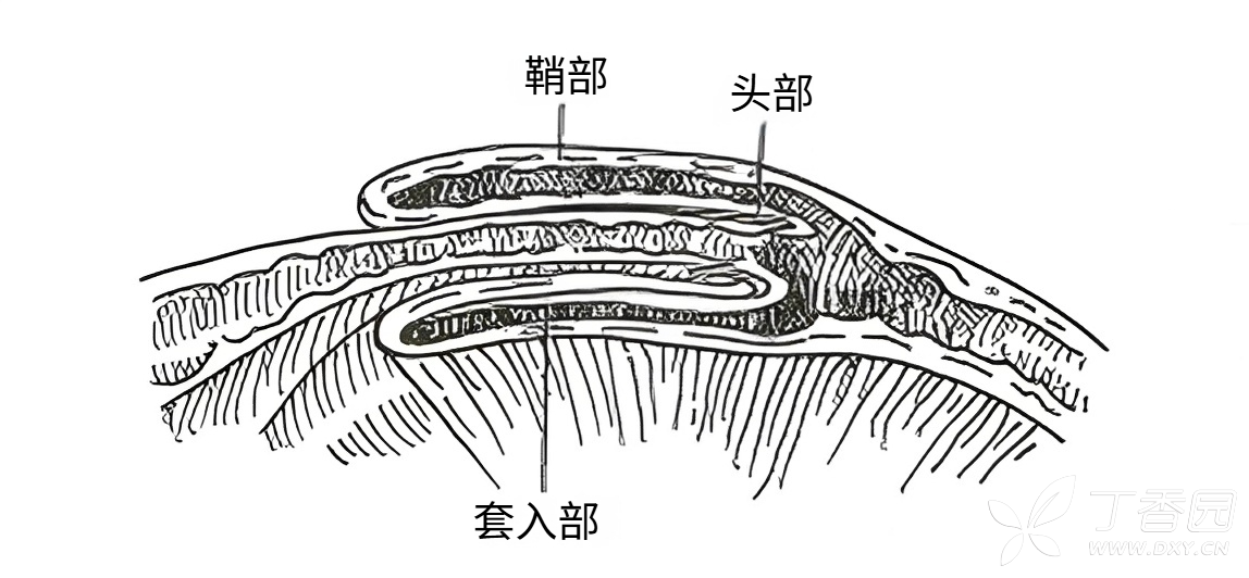 图片预览